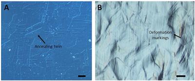 Modulating the Surface Properties of Metallic Implants and the Response of Breast Cancer Cells by Surface Relief Induced via Bulk Plastic Deformation